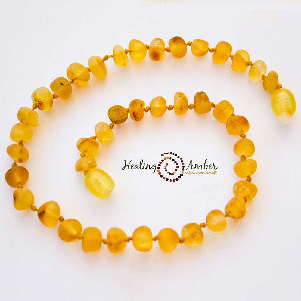 Healing Amber Necklace 11"